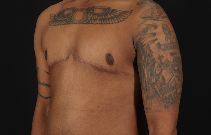 After - left_oblique