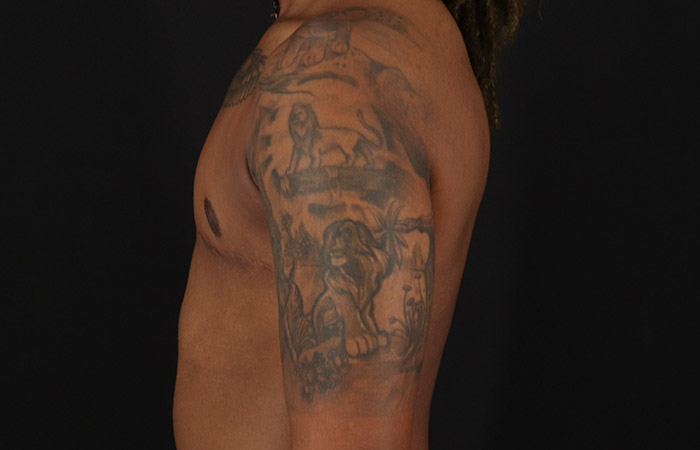 After - left_lateral