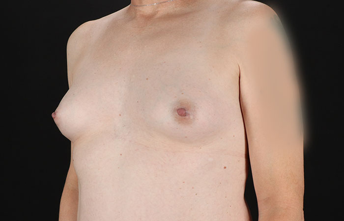 Before - left_oblique