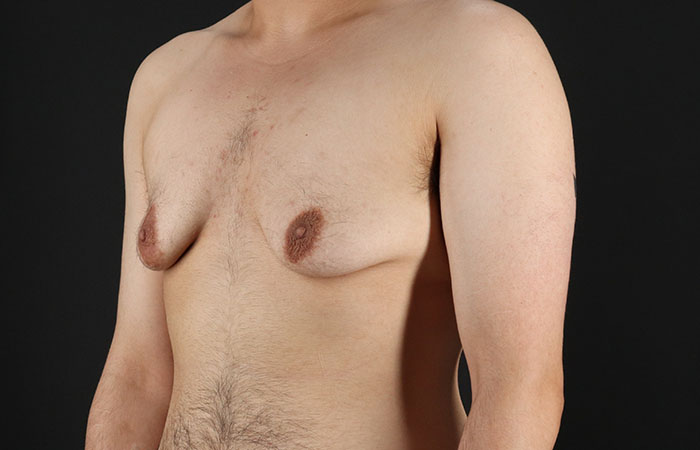 Before - left_oblique