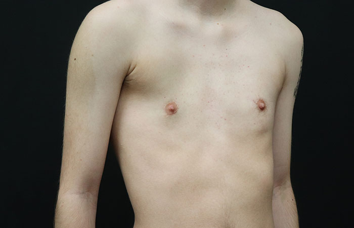 After - right_oblique