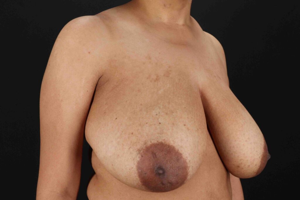 Before - right_oblique