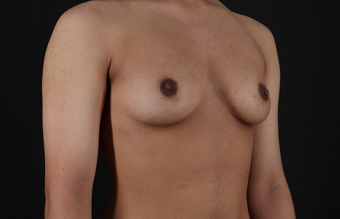 Before - right_oblique