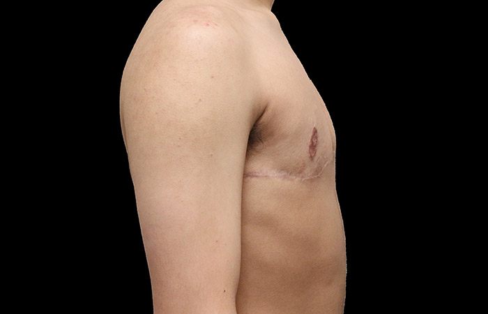 After - right_lateral