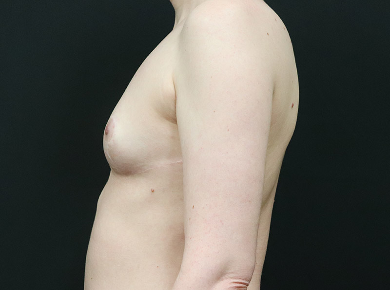 After - left_lateral