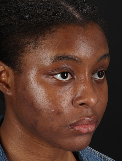 Before - right_oblique