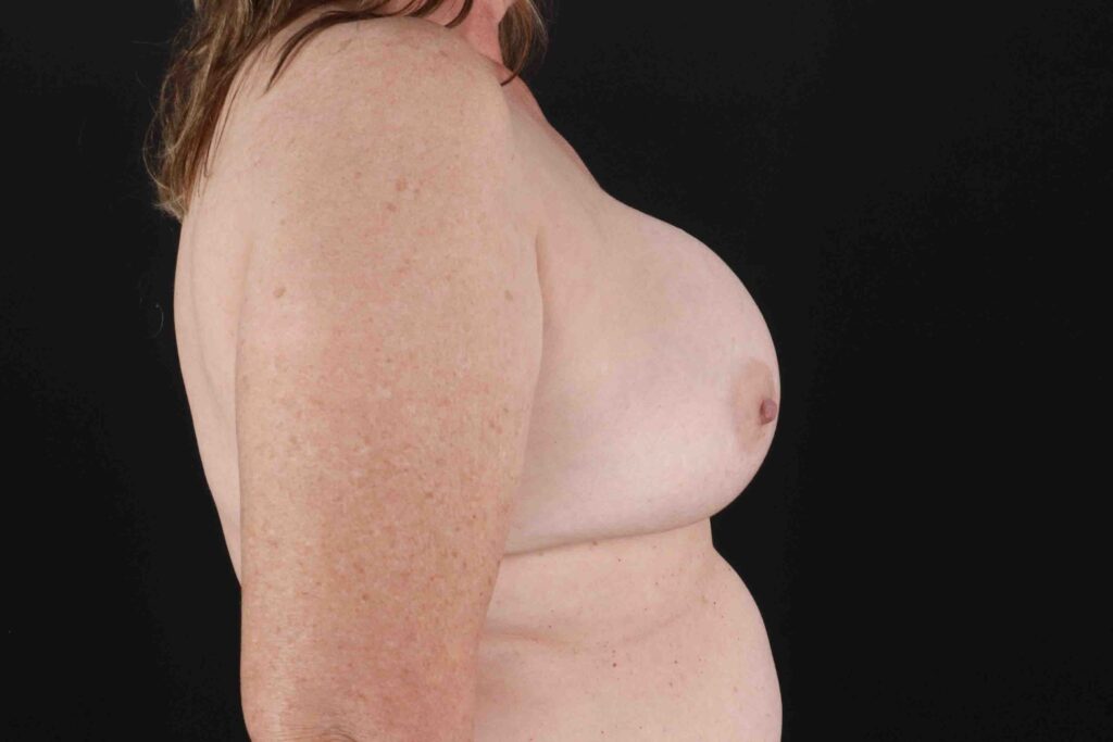 Before - right_lateral