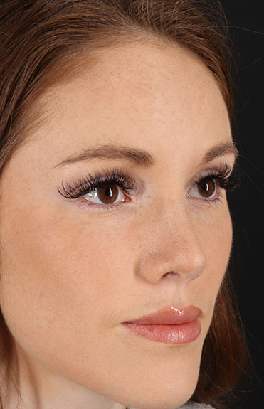 After - right_oblique