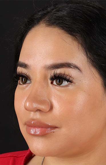 After - left_oblique