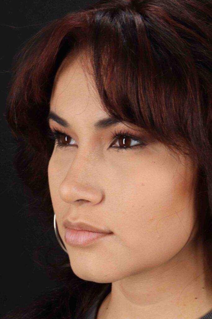 After - left_oblique