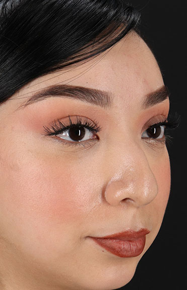 Before - right_oblique