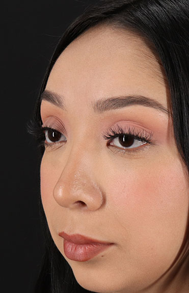 After - left_oblique