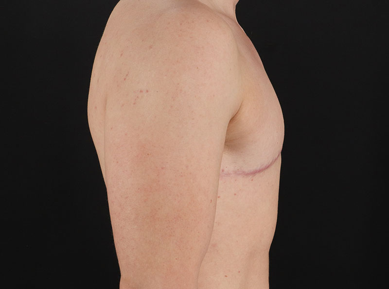 After - right_lateral