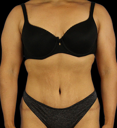 After - 721-2023-04-03-RR