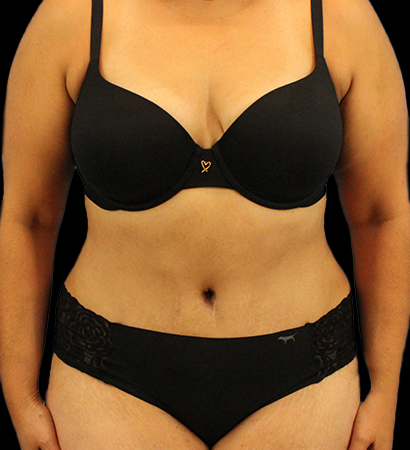 After - 717-2023-04-03-RR