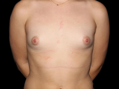 Before - 711-2023-04-03-RR