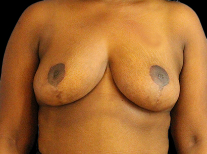 After - 706-2023-04-03-RR