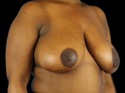 Before - right_oblique