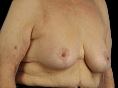 After - right_lateral