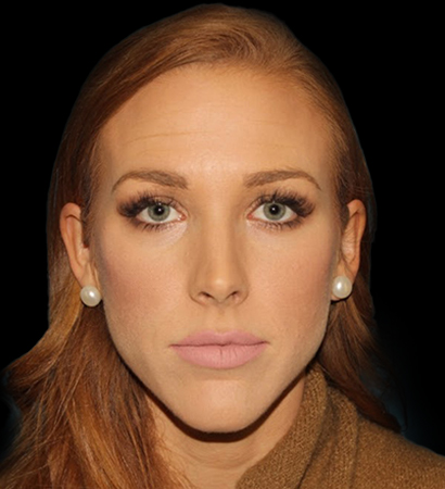 Before - 704-2023-04-03-RR