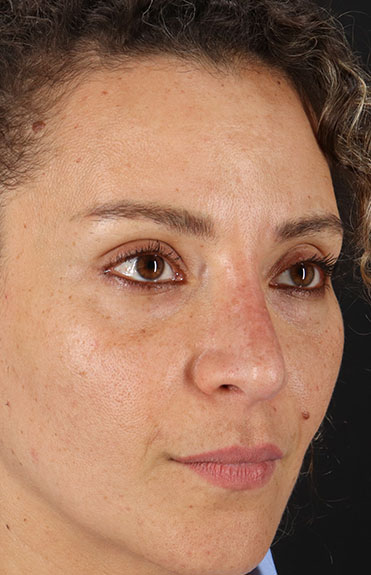 After - right_oblique