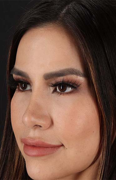 After - left_oblique