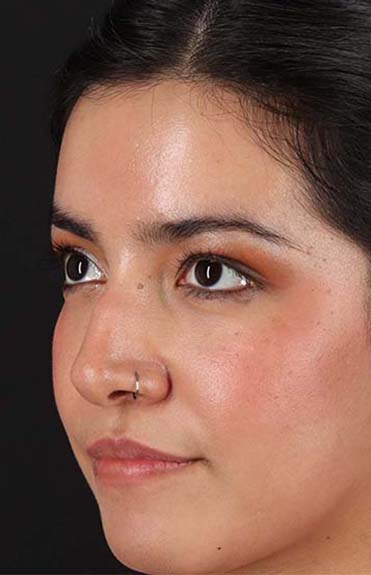 Before - left_oblique