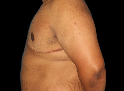 After - left_lateral