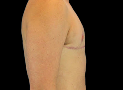 After - right_lateral