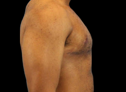 After - right_lateral