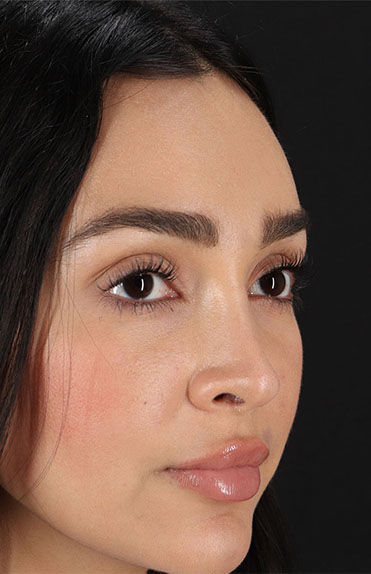 After - right_oblique