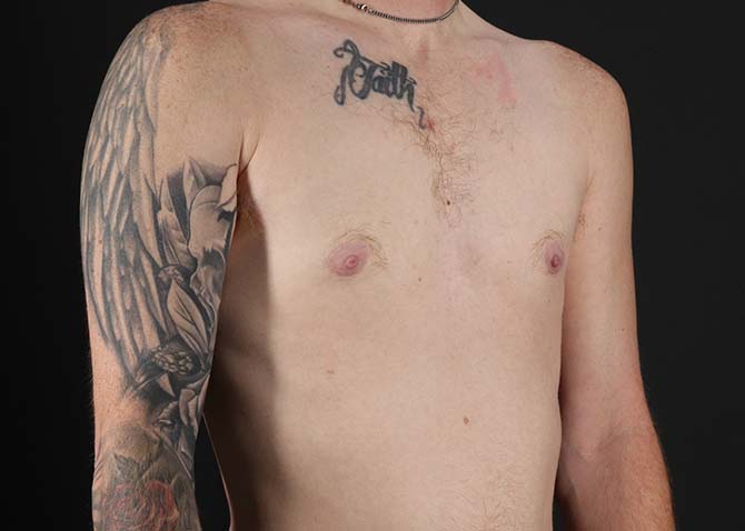 After - right_oblique