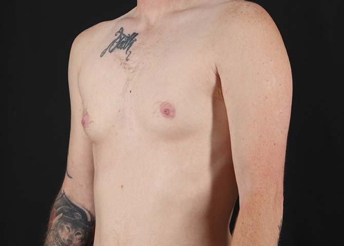 Before - left_oblique