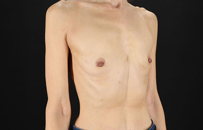 Before - right_oblique