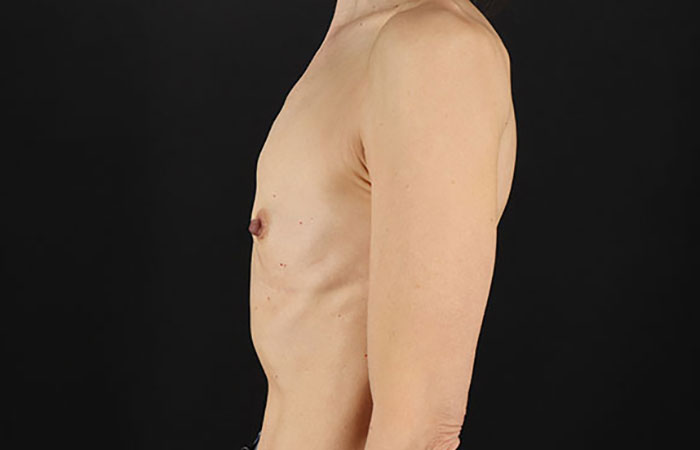 Before - left_lateral