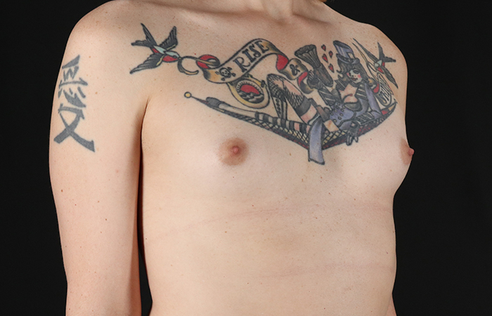 Before - right_oblique