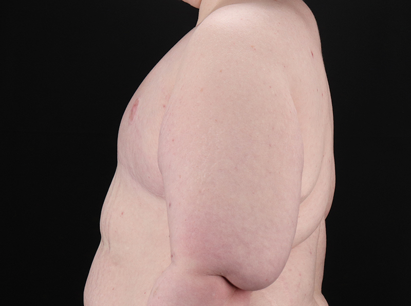 After - left_lateral