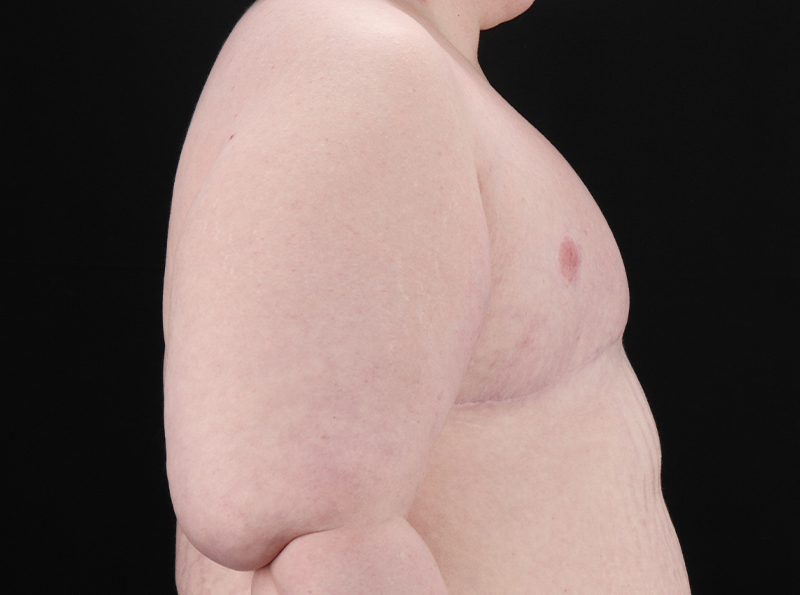 After - right_lateral