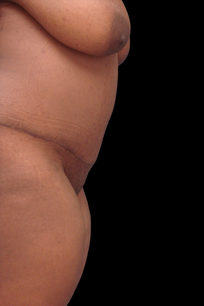 After - right_lateral