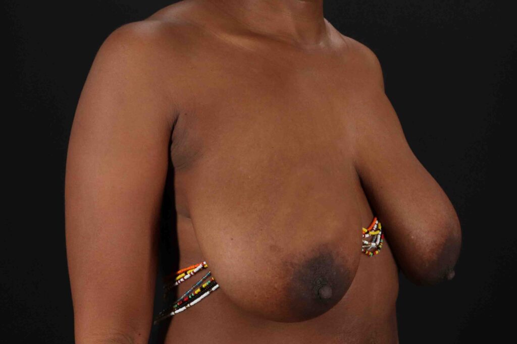 Before - right_oblique