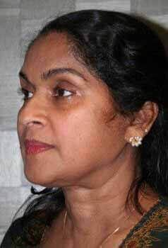 Before - left_oblique