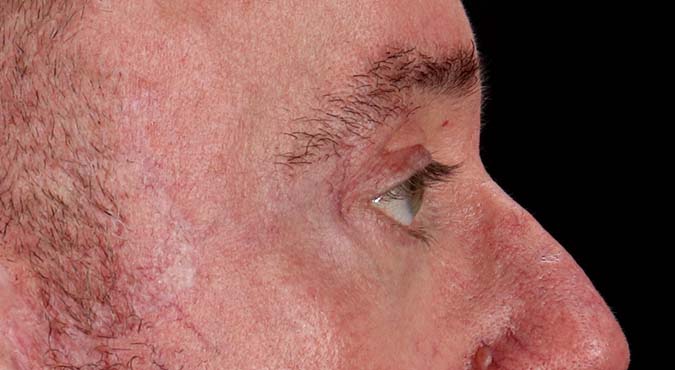 After - right_lateral