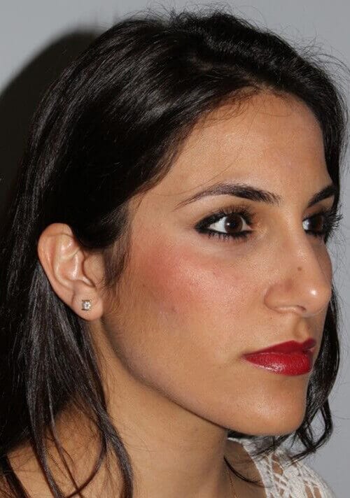 After - right_oblique