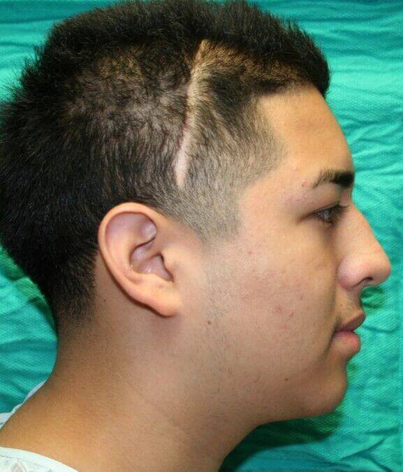 After - right_lateral