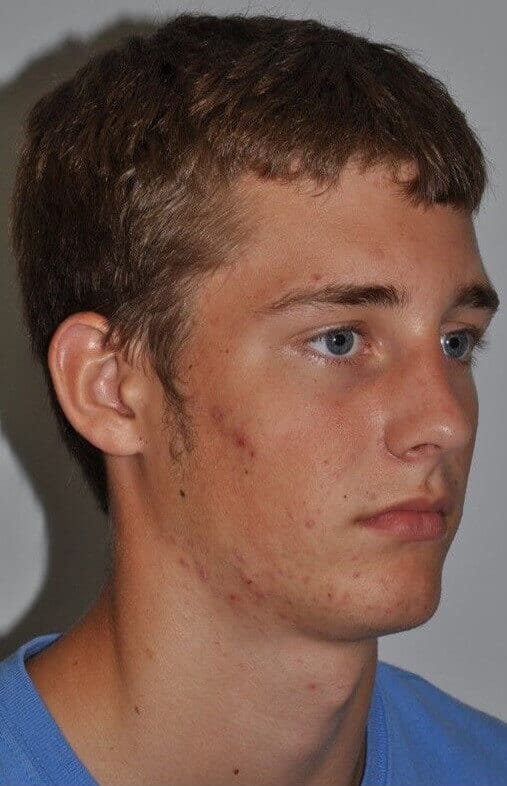 Before - right_oblique