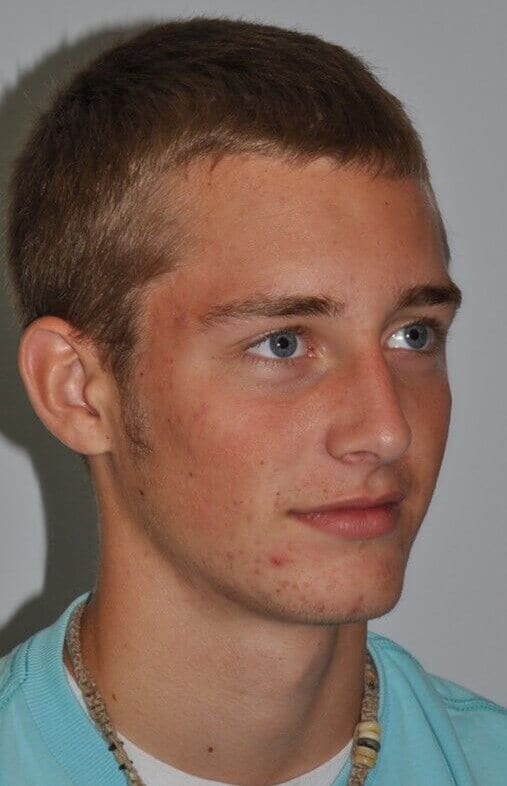 After - right_oblique