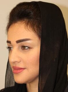 Before - left_oblique