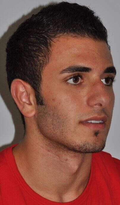 Before - right_oblique