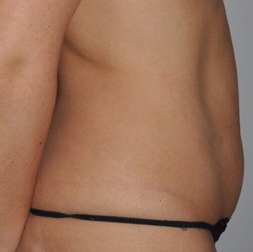 Before - right_lateral