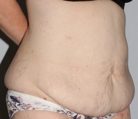 Before - right_oblique